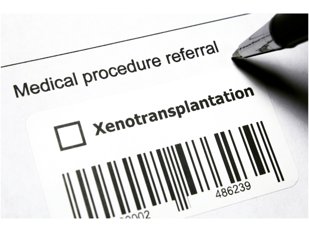 ÓRGANOS DE CERDO EDITADOS GENÉTICAMENTE: UNA ESPERANZA PARA QUIENES ESPERAN UN&nbsp;TRASPLANTE