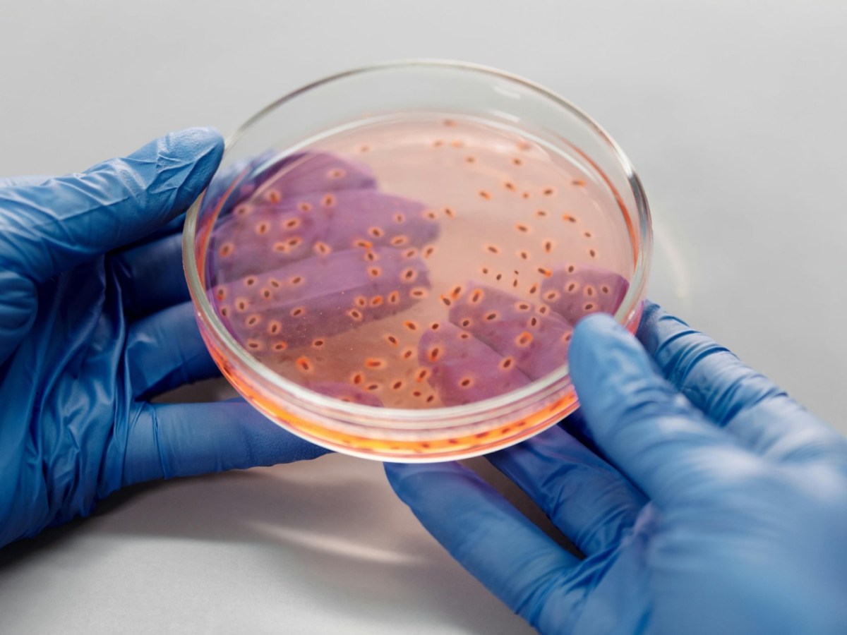LA SUPERBACTERIA DE LOS HOSPITALES: EL PELIGRO OCULTO DE ACINETOBACTER&nbsp;BAUMANNII