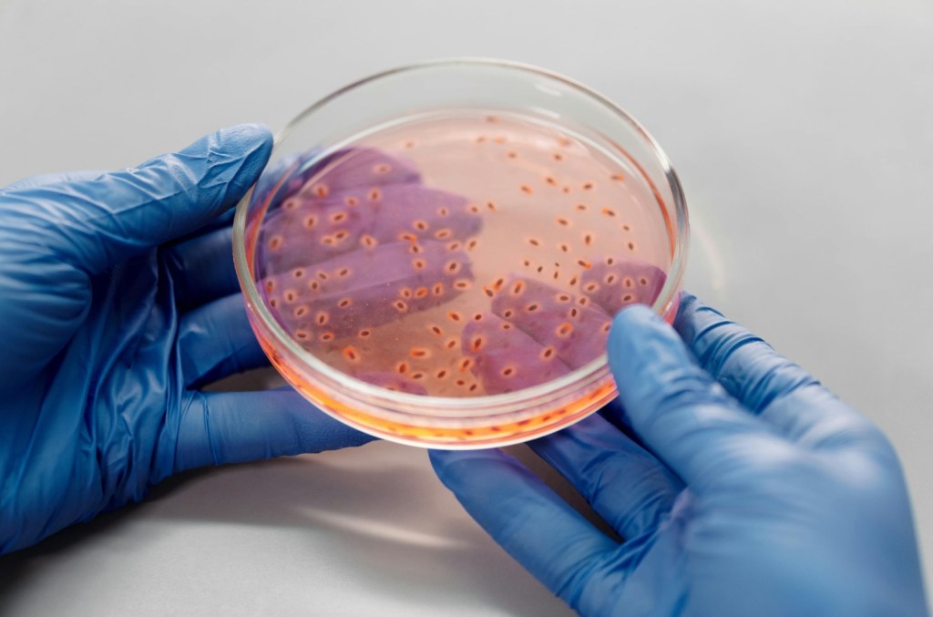 LA SUPERBACTERIA DE LOS HOSPITALES: EL PELIGRO OCULTO DE ACINETOBACTER BAUMANNII